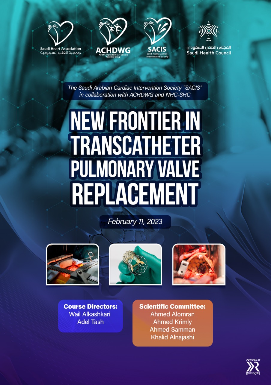 New Frontier in Trans catheter Pulmonary Valve replacement – February 11, 2023